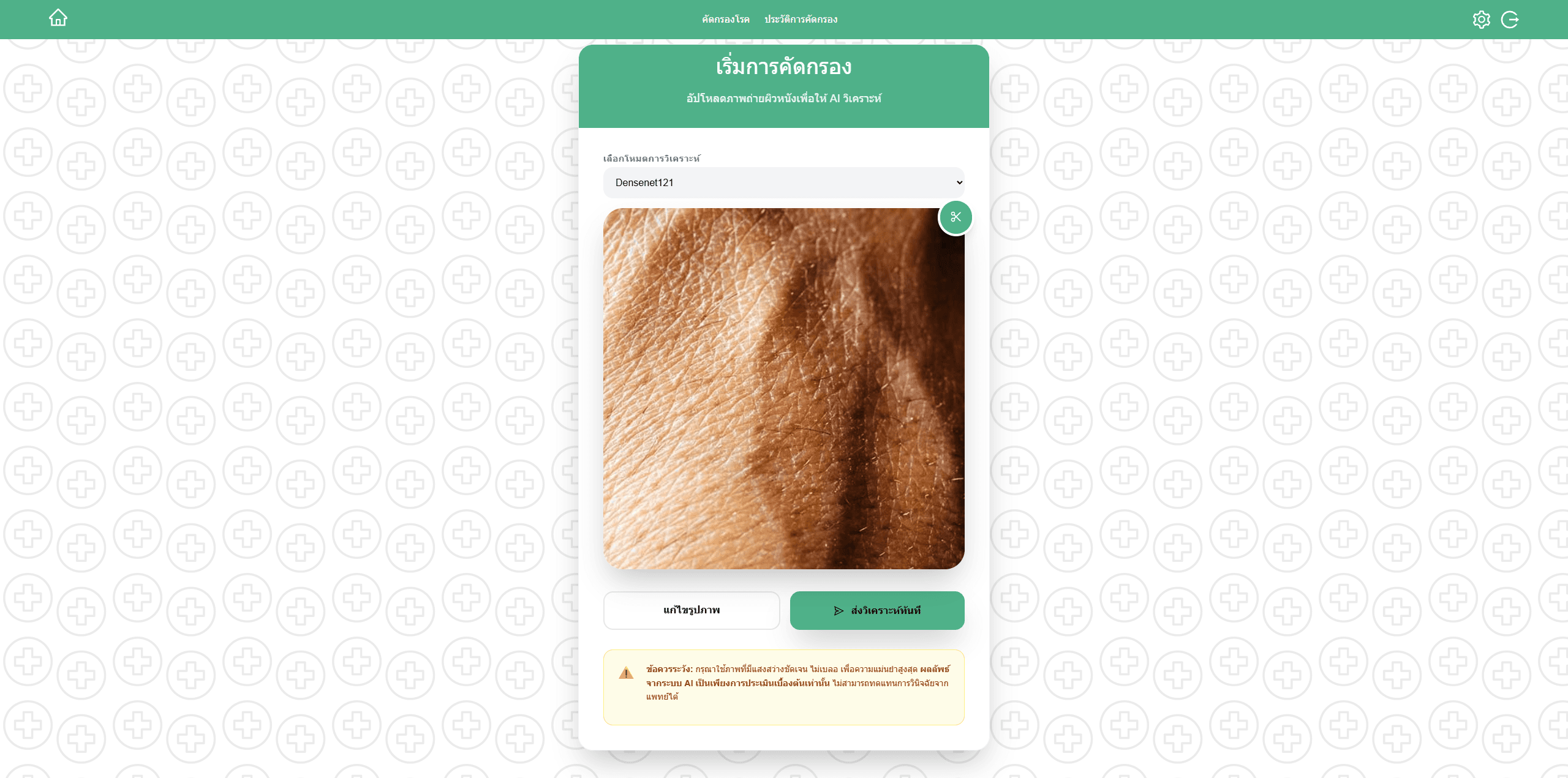 Skin disease ML(senior project) screenshot 2